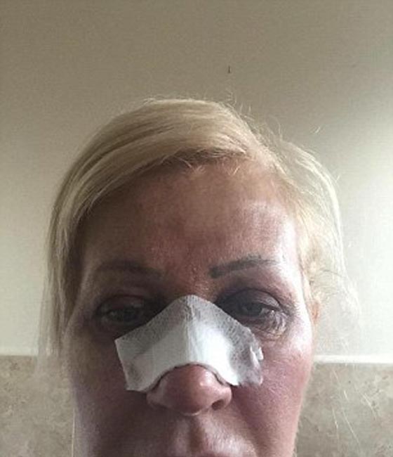 امرأة بريطانية تبذر 60 الف دولار على التجميل لتصبح شبيهة ابنتها! صورة رقم 10