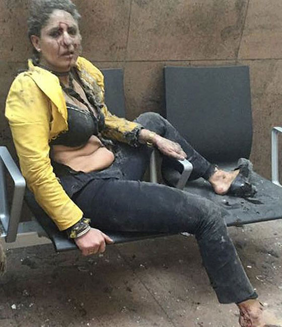صورة بالف كلمة.. امرأة على وشك الانهيار مزق تفجير بروكسل سترتها صورة رقم 3