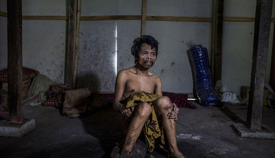 جولة فظيعة في اقبية ذوي الاحتياجات الاندونيسيين المريعة صورة رقم 1