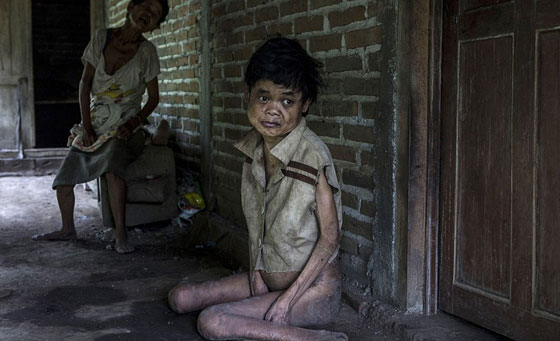 جولة فظيعة في اقبية ذوي الاحتياجات الاندونيسيين المريعة صورة رقم 2