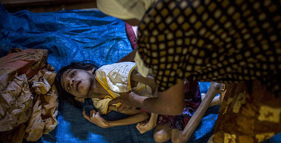 جولة فظيعة في اقبية ذوي الاحتياجات الاندونيسيين المريعة صورة رقم 3