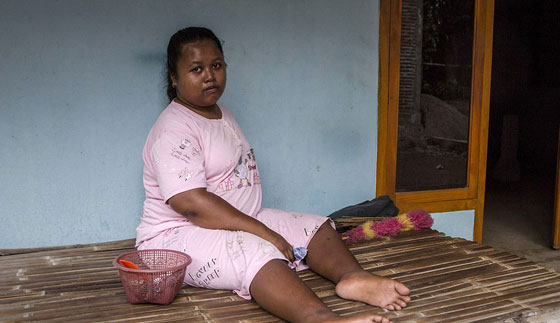 جولة فظيعة في اقبية ذوي الاحتياجات الاندونيسيين المريعة صورة رقم 15