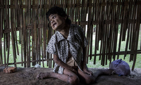 جولة فظيعة في اقبية ذوي الاحتياجات الاندونيسيين المريعة صورة رقم 17