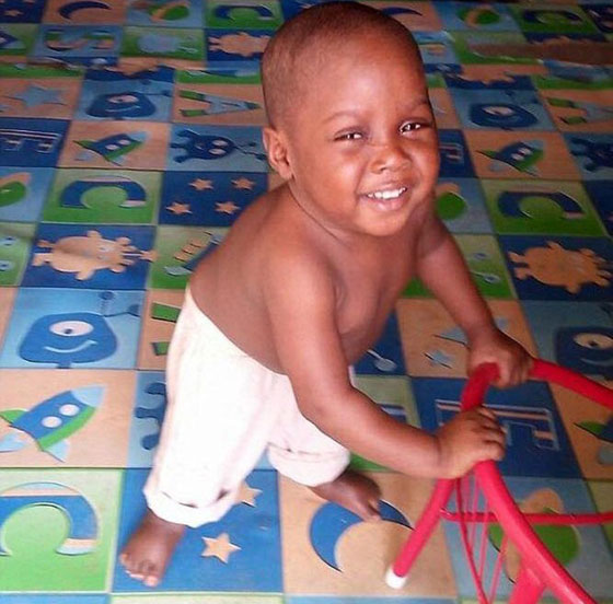  الطفل الذي هز ضمير العالم عاد للحياة وغابت عنه علامات الجوع والهزال صورة رقم 7