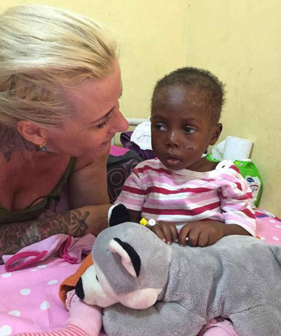  الطفل الذي هز ضمير العالم عاد للحياة وغابت عنه علامات الجوع والهزال صورة رقم 6