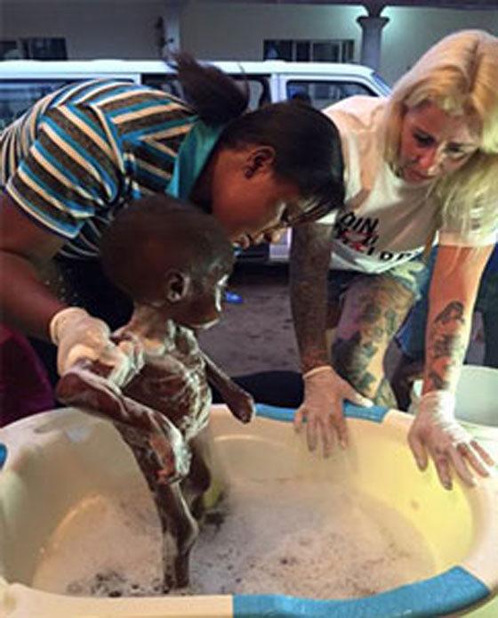  الطفل الذي هز ضمير العالم عاد للحياة وغابت عنه علامات الجوع والهزال صورة رقم 5