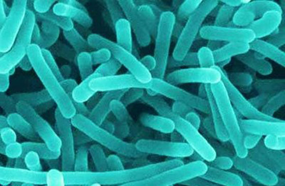 معلومة جديدة من اليابان.. اكتشاف بكتيريا تلتهم الاجهزة الإلكترونية!! صورة رقم 1