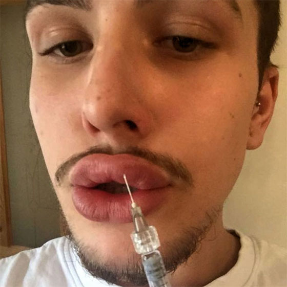 هوس المشاهير.. انفق 21 الف جنيه استرليني للتشبه بكيم كاردشيان صورة رقم 3