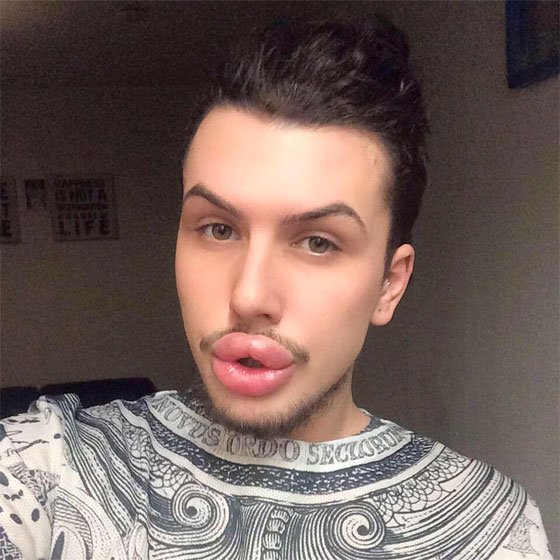 هوس المشاهير.. انفق 21 الف جنيه استرليني للتشبه بكيم كاردشيان صورة رقم 9
