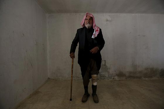 لفتة انسانية رائعة.. اطراف صناعية مجانية لضحايا الحرب السورية صورة رقم 5