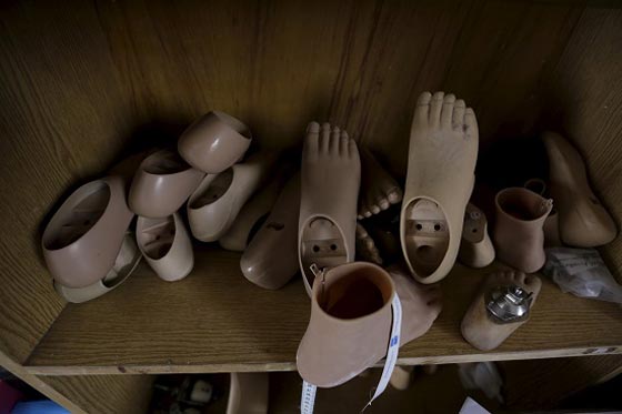 لفتة انسانية رائعة.. اطراف صناعية مجانية لضحايا الحرب السورية صورة رقم 7