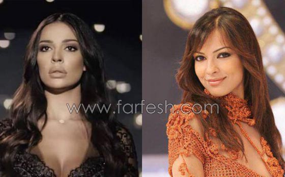 صور الفنانات قبل وبعد عمليات تجميل تكبير الشفاه صورة رقم 6