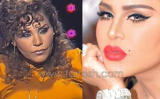 صور الفنانات قبل وبعد عمليات تجميل تكبير الشفاه صورة رقم 2