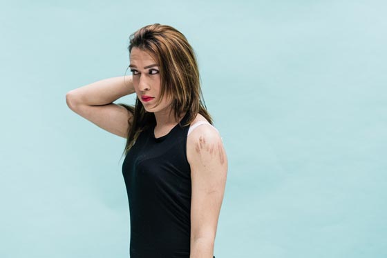 قصة شاب سوري مثلي هرب الى النمسا وتحوّل الى امرأة ويعمل راقصة شرقية! صورة رقم 3