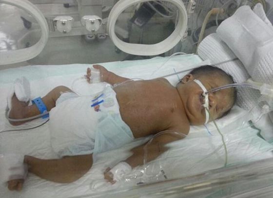  انجاز طبي.. ولادة طفل بعد شهرين من موت امه! صورة رقم 1