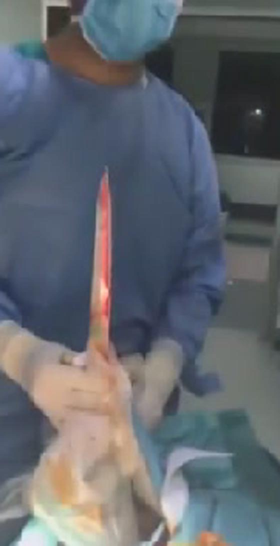 مشهد مروع لاطباء ينتزعون سيفا من صدر رجل اراد الانتحار صورة رقم 1