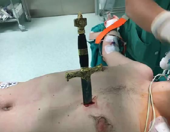 مشهد مروع لاطباء ينتزعون سيفا من صدر رجل اراد الانتحار صورة رقم 2