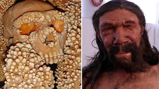 لاول مرة.. علماء يعيدون تشكيل وجه رجل عمره 150 الف سنة صورة رقم 1