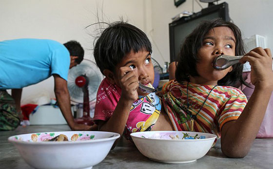 توأمان ملتصقتان تكملان السابعة بعد ان كانت فرصهما في العيش ضئيلة صورة رقم 2