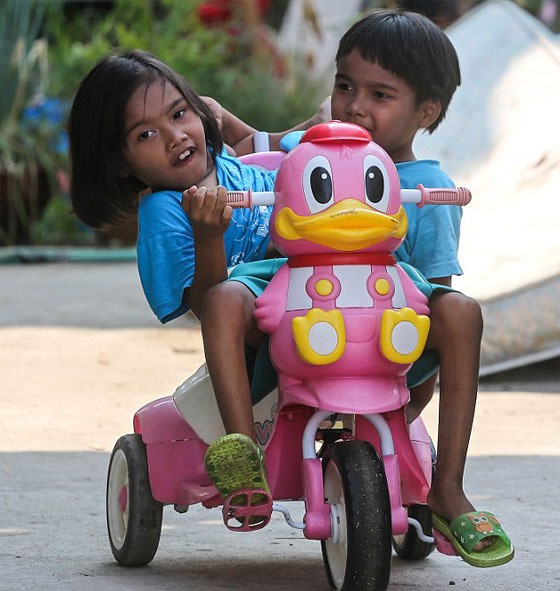 توأمان ملتصقتان تكملان السابعة بعد ان كانت فرصهما في العيش ضئيلة صورة رقم 6