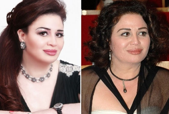 صور النجوم قبل وبعد الـ (فوتوشوب): لن تصدق التغيير! صورة رقم 7