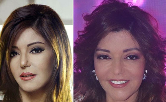 صور النجوم قبل وبعد الـ (فوتوشوب): لن تصدق التغيير! صورة رقم 9