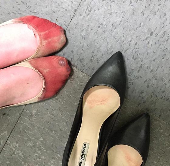 صورة مؤلمة: نادلة مجبرة على لبس الكعب العالي وقدمها تنزف دما  صورة رقم 1