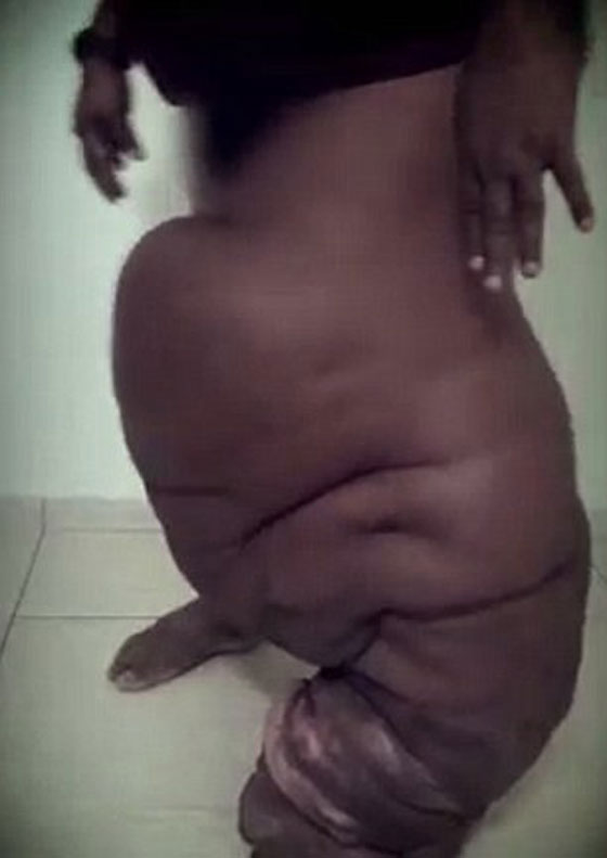 احذر.. لدغة بعوضة قد تحولك الى فيل!! صورة رقم 5