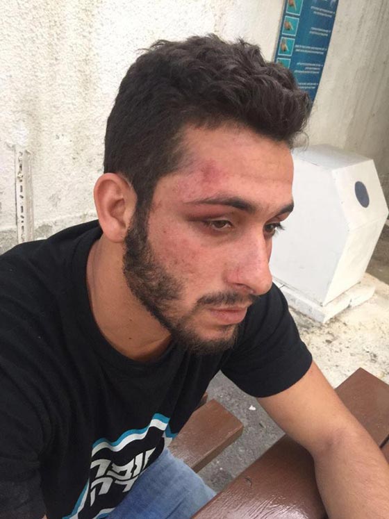 فيديو مثير.. افراد الشرطة يتحولون الى افراد عصابة ويعتدون على شاب عربي بتل ابيب صورة رقم 2 فيديو مثير.. افراد الشرطة يتحولون الى افراد عصابة ويعتدون على شاب عربي بتل ابيب صورة رقم 2