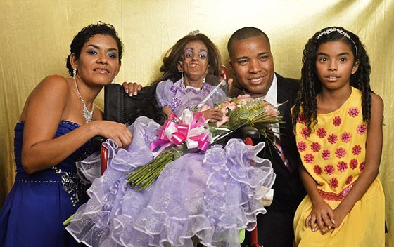 صور غريبة.. الام عمرها 35 عاما اما ابنتها فتجاوزت التسعين! صورة رقم 2 صور غريبة.. الام عمرها 35 عاما اما ابنتها فتجاوزت التسعين! صورة رقم 2