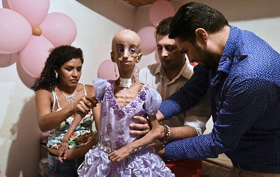 صور غريبة.. الام عمرها 35 عاما اما ابنتها فتجاوزت التسعين! صورة رقم 4 صور غريبة.. الام عمرها 35 عاما اما ابنتها فتجاوزت التسعين! صورة رقم 4