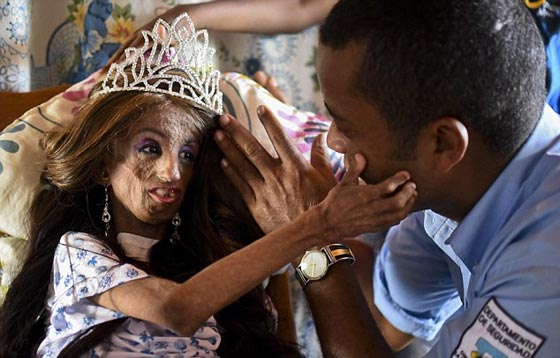 صور غريبة.. الام عمرها 35 عاما اما ابنتها فتجاوزت التسعين! صورة رقم 8 صور غريبة.. الام عمرها 35 عاما اما ابنتها فتجاوزت التسعين! صورة رقم 8