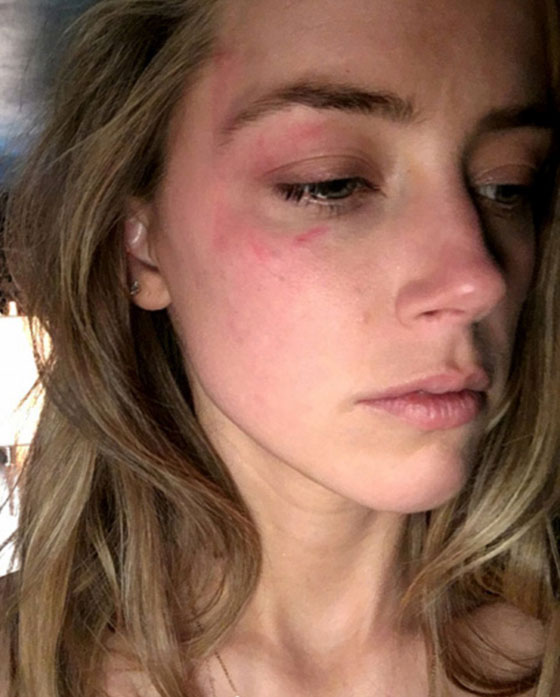  النجم جوني ديب ممنوع من الاقتراب من زوجته بعد تعنيفها صورة رقم 13