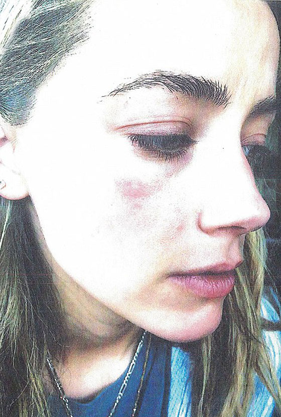  النجم جوني ديب ممنوع من الاقتراب من زوجته بعد تعنيفها صورة رقم 21