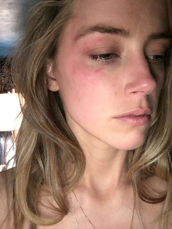  النجم جوني ديب ممنوع من الاقتراب من زوجته بعد تعنيفها صورة رقم 4