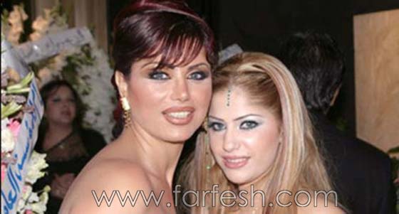  صور نورمان اسعد قبل وبعد عمليات التجميل تذهل جمهورها! صورة رقم 2