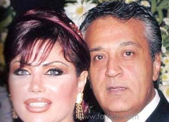  صور نورمان اسعد قبل وبعد عمليات التجميل تذهل جمهورها! صورة رقم 4