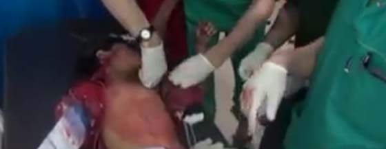 فيديو مؤثر.. طفل سوري جريح يتوسل الاطباء عدم قص ثيابه الجديدة  صورة رقم 2