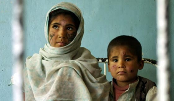 سوريا تصدر وباءً خطيرا الى الشرق الاوسط.. تنقله ذبابة الرمل صورة رقم 5