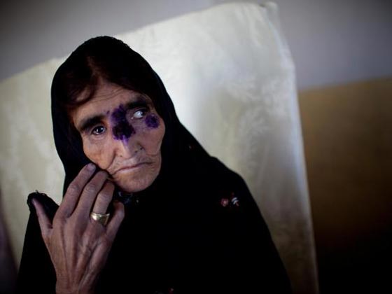 سوريا تصدر وباءً خطيرا الى الشرق الاوسط.. تنقله ذبابة الرمل صورة رقم 4