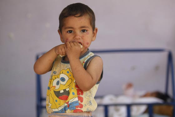 سوريا تصدر وباءً خطيرا الى الشرق الاوسط.. تنقله ذبابة الرمل صورة رقم 10