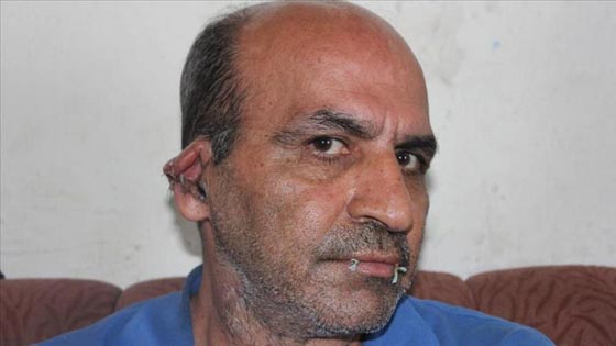 اخاطة الفم والاذنين.. طريقة احتجاج عملية للاجئ سياسي ايراني صورة رقم 1 اخاطة الفم والاذنين.. طريقة احتجاج عملية للاجئ سياسي ايراني صورة رقم 1