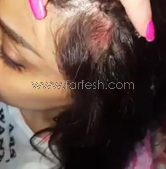 فيديو رولا يموت اخت هيفاء وهبي تتعرض لاصابة في الرأس، فمن تتهم؟ صورة رقم 1