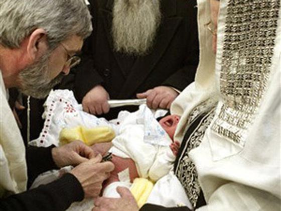كل شيء عن الختان وقضيته الساخنة في اسرائيل.. بالفيديو والصور صورة رقم 7