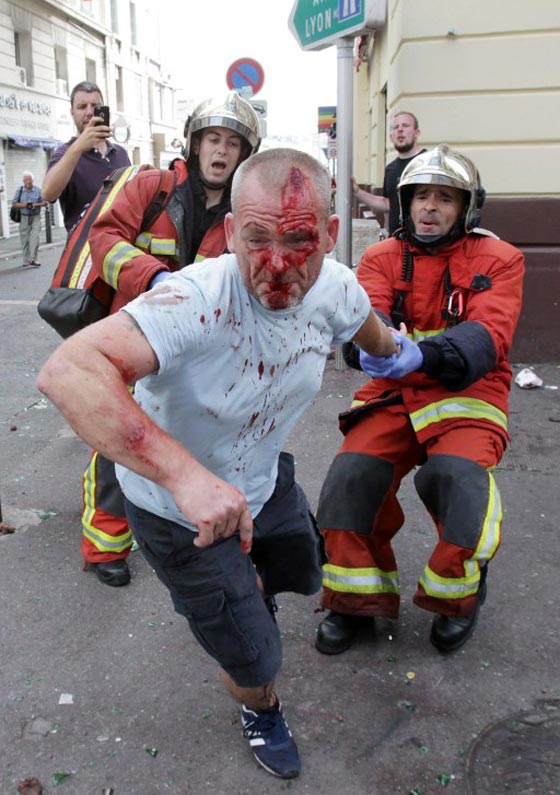 31 جريحا في شجار على الكرة بين روسيا وانجلترا صورة رقم 14