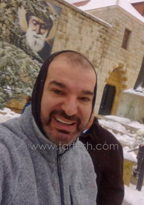 طوني خليفة يعترف: أجريت عملية تجميل في هذا المكان من جسمي! صورة رقم 6