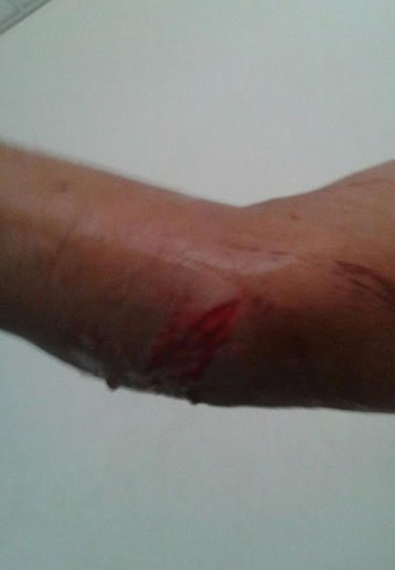 صور: كلاب شرسة تهشم وجه طفلة مصرية وتشوه جسدها بعد صلاة التراويح  صورة رقم 3