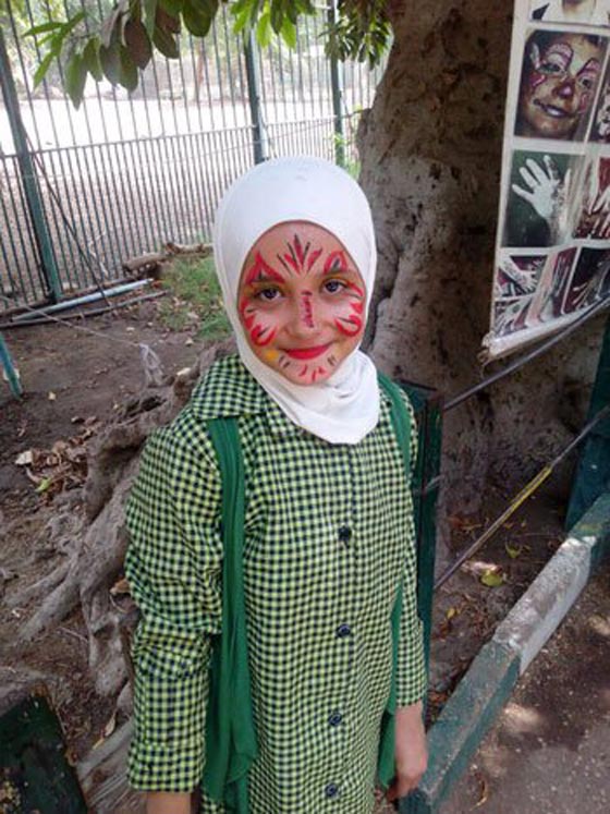 صور: كلاب شرسة تهشم وجه طفلة مصرية وتشوه جسدها بعد صلاة التراويح  صورة رقم 6