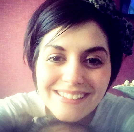 حادث رهيب.. مسحوق الغسيل يشوه  وجه طفلة بنسبة 95%  صورة رقم 4