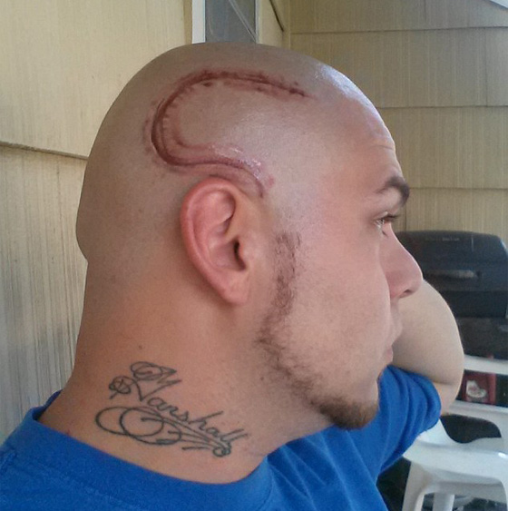 والد يدعم طفله المصاب بالسرطان بوشم غير تقليدي صورة رقم 3